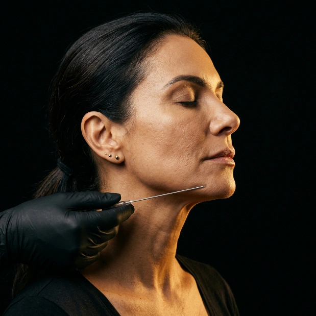 BIOESTIMULADOR DE COLÁGENO SCULPTRA
